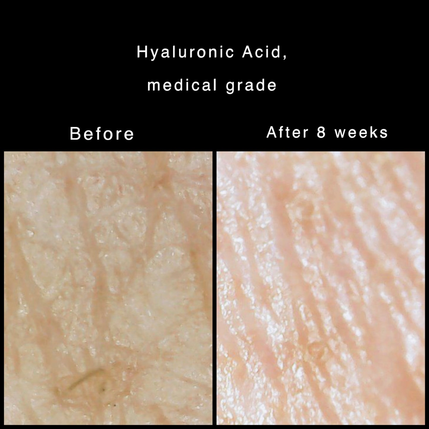 Hyaluronic Acid + Vitamin B5 Concentrate
