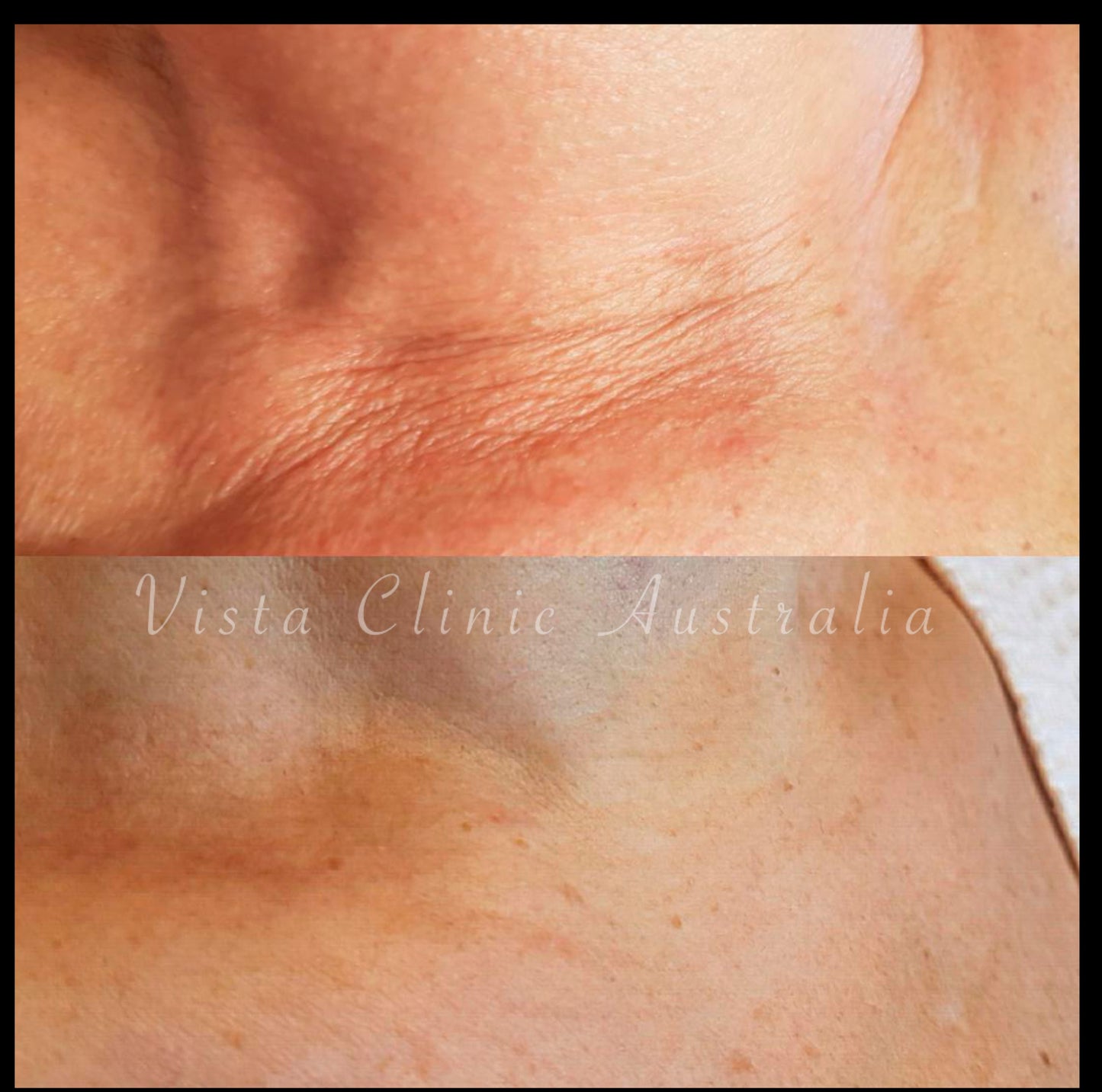 Skin Consultation with a skin quality clinician Dr Jenny Parsons