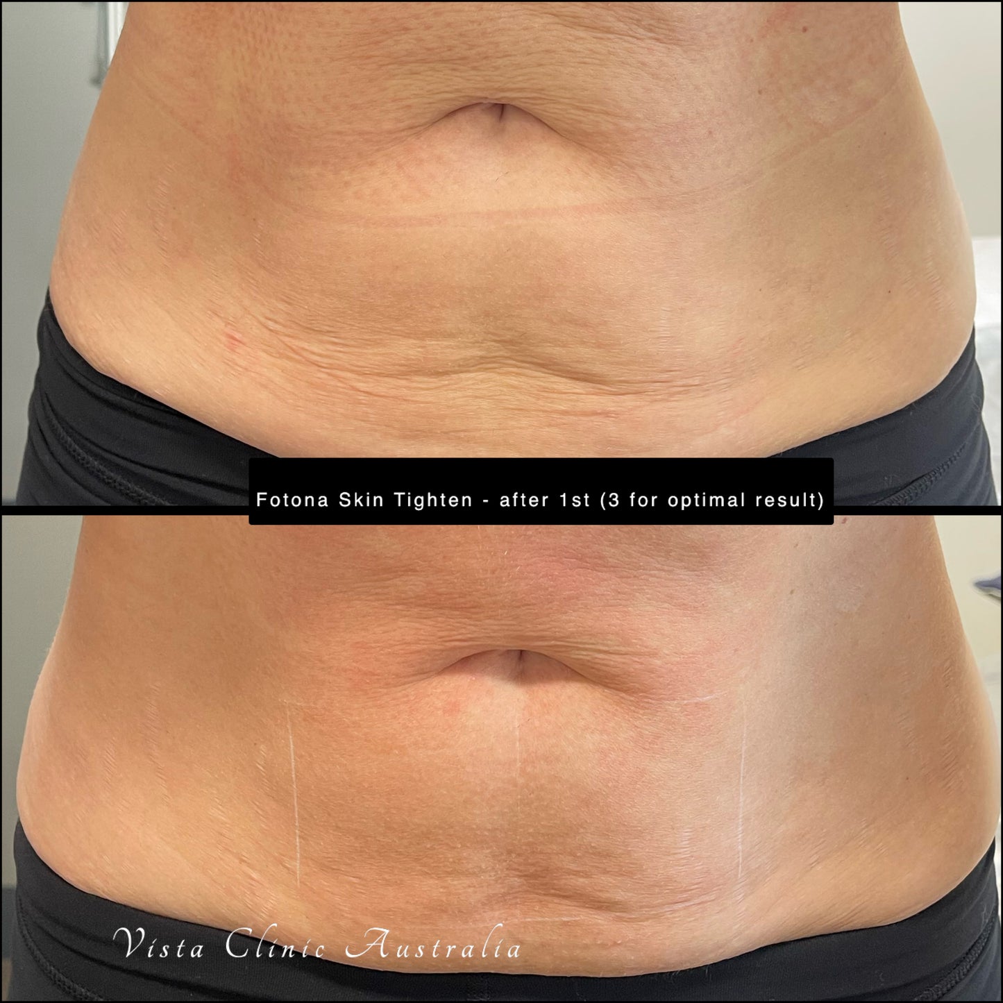 Skin Consultation with a skin quality clinician Dr Jenny Parsons