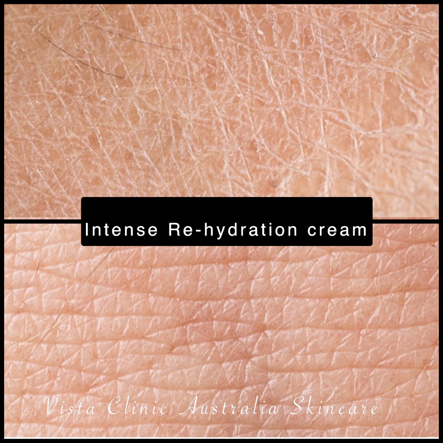 Intense Re-Hydration Cream - Medical Pro