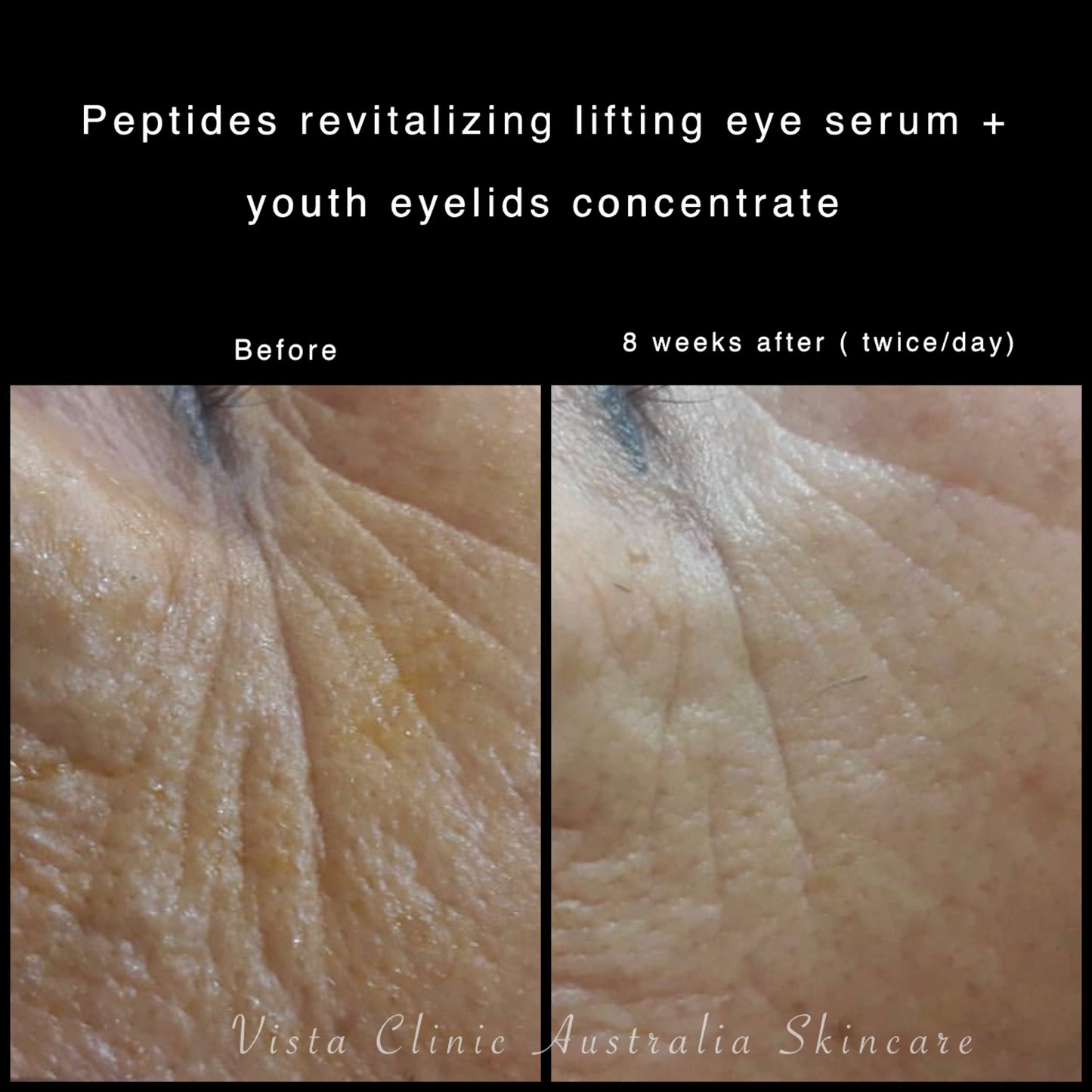 Revitalizing Lifting Eye Cream