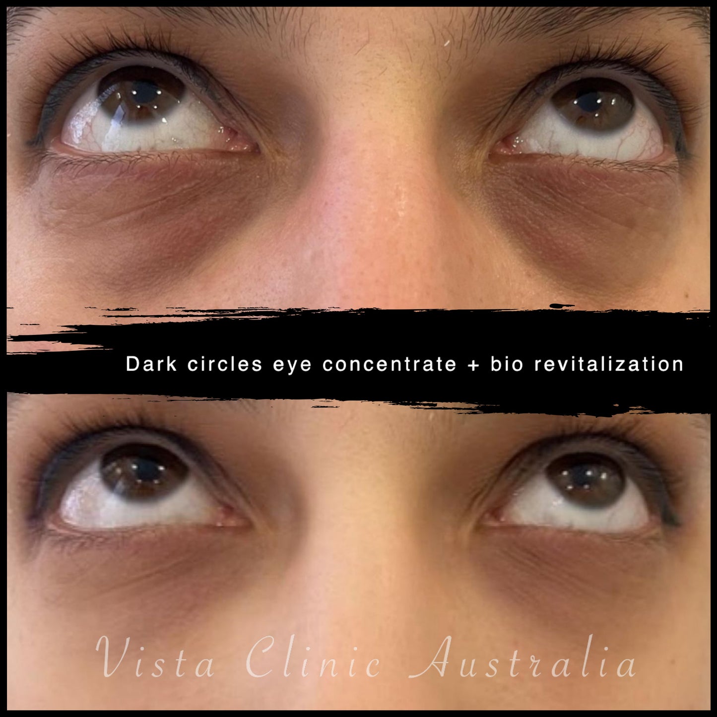 Dark Circle Eye Cream