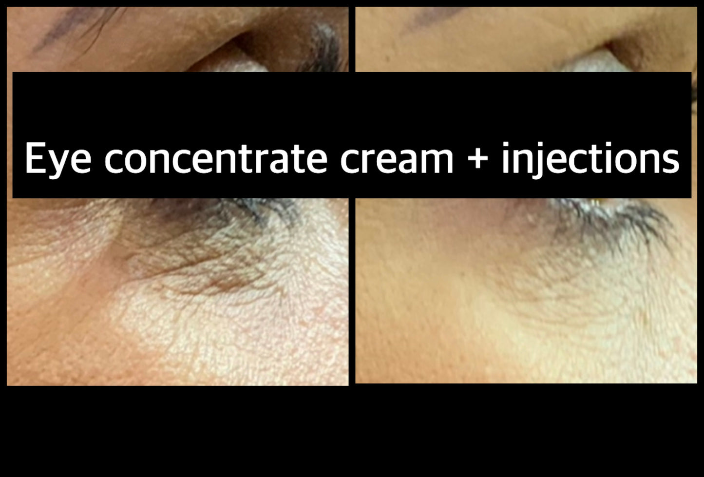 Youthful Eyelids Concentrate